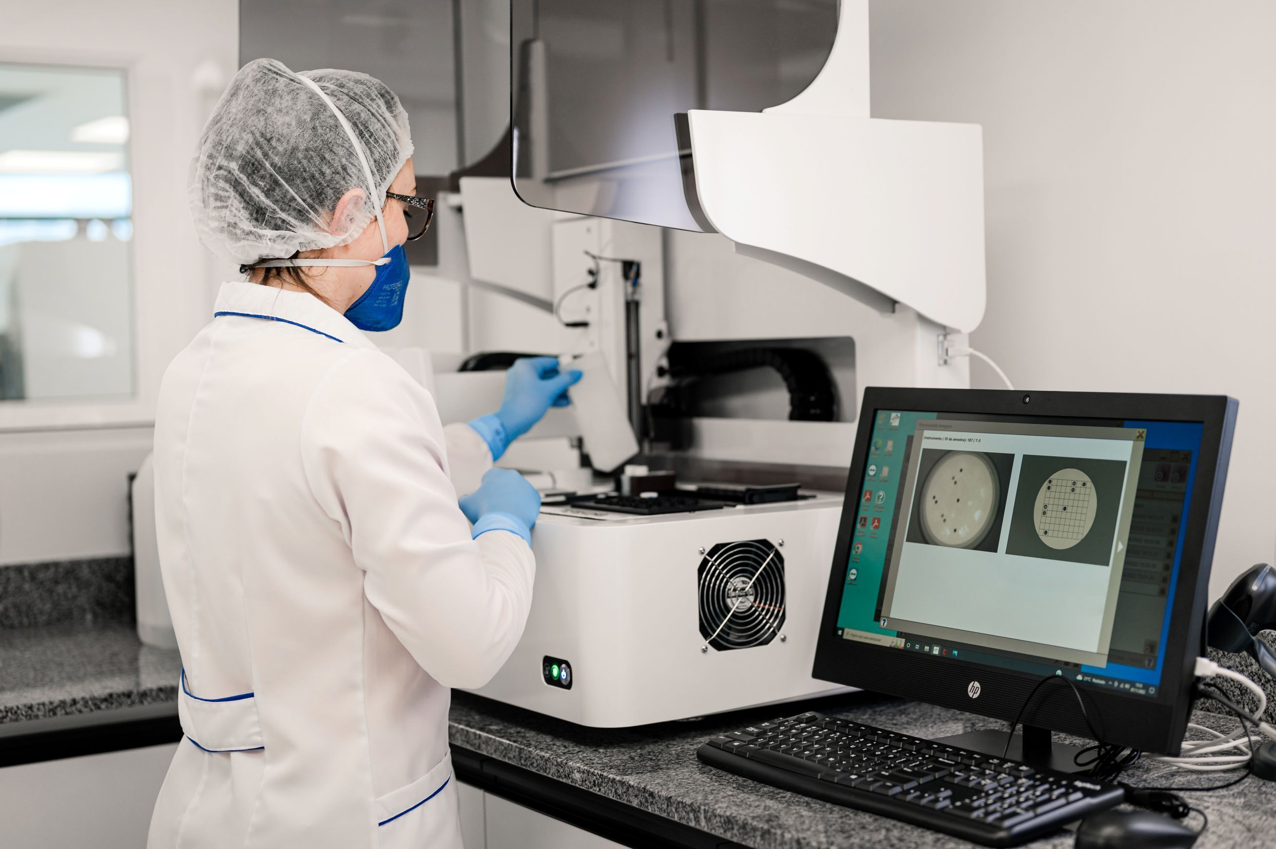 Laboratório Univates oferece exame de painel molecular para diagnóstico rápido de meningite e encefalite