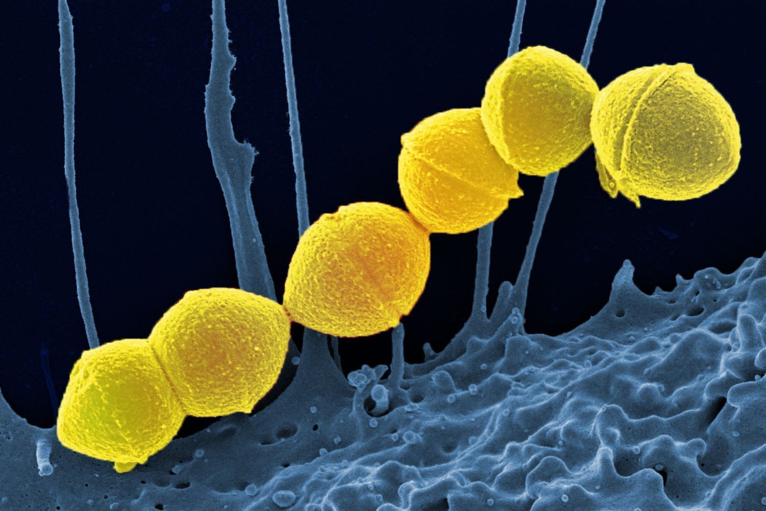 Pesquisa da Univates analisa mortalidade por cardiopatia reumática no Rio Grande do Sul e revela padrões por idade e sexo